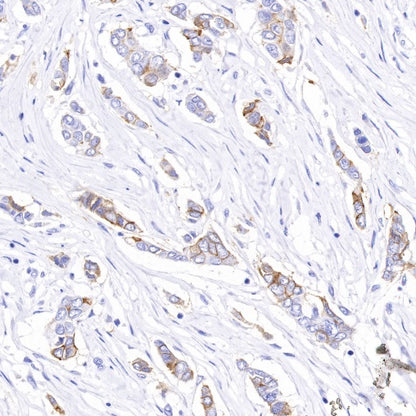 B7-H4 Recombinant Rabbit mAb (SDT-314-447-2)