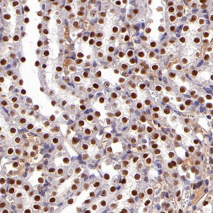 O-Linked N-Acetylglucosamine Rabbit mAb (S-R256)