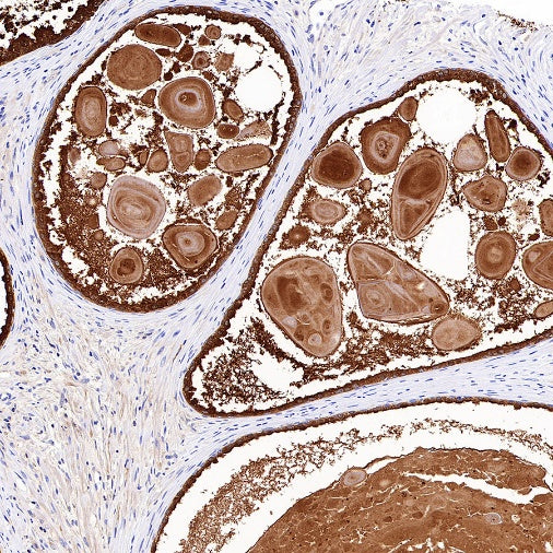 KLK2 Recombinant Rabbit mAb (SDT-4461-80)
