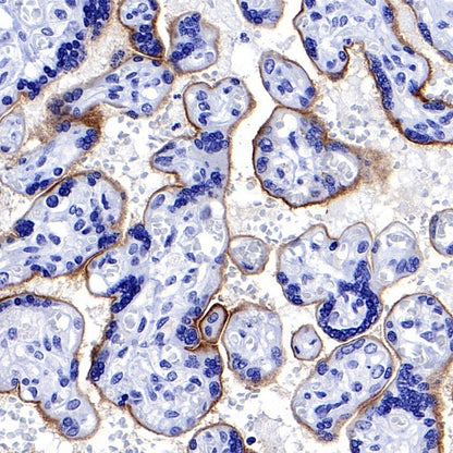 MUC1/EMA Mouse mAb (SDT-777-37)
