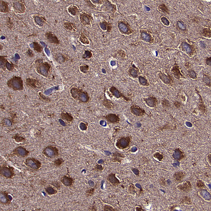 HSP90 Recombinant Mouse mAb (S-5484)
