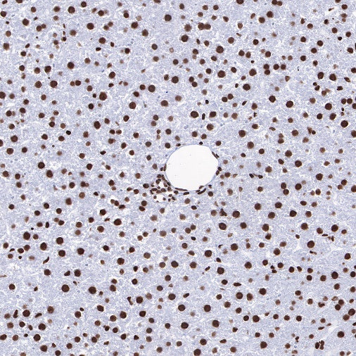 Histone H3 (acetyl K4 + K9 + K18) Rabbit polyclonal antibody