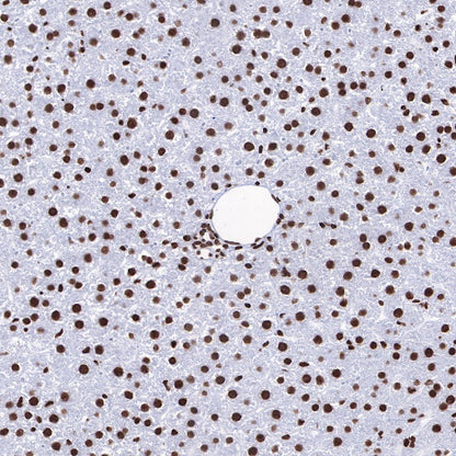 Histone H3 (acetyl K4 + K9 + K18) Rabbit polyclonal antibody