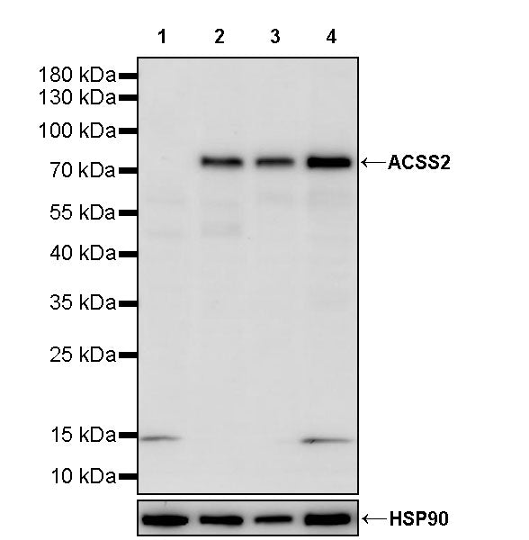 ACSS2 Recombinant Rabbit mAb (S-4117-9)