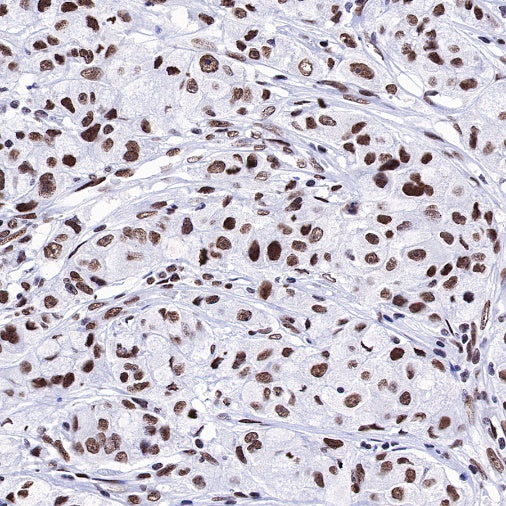 Dnmt1 Recombinant Rabbit mAb (S-R324)