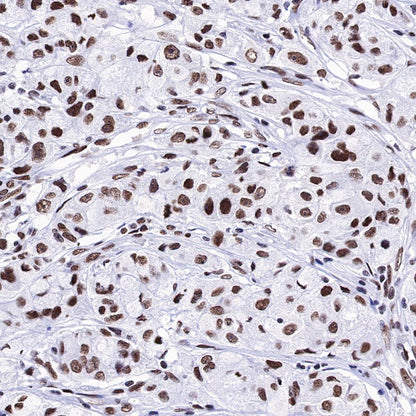 Dnmt1 Recombinant Rabbit mAb (S-R324)