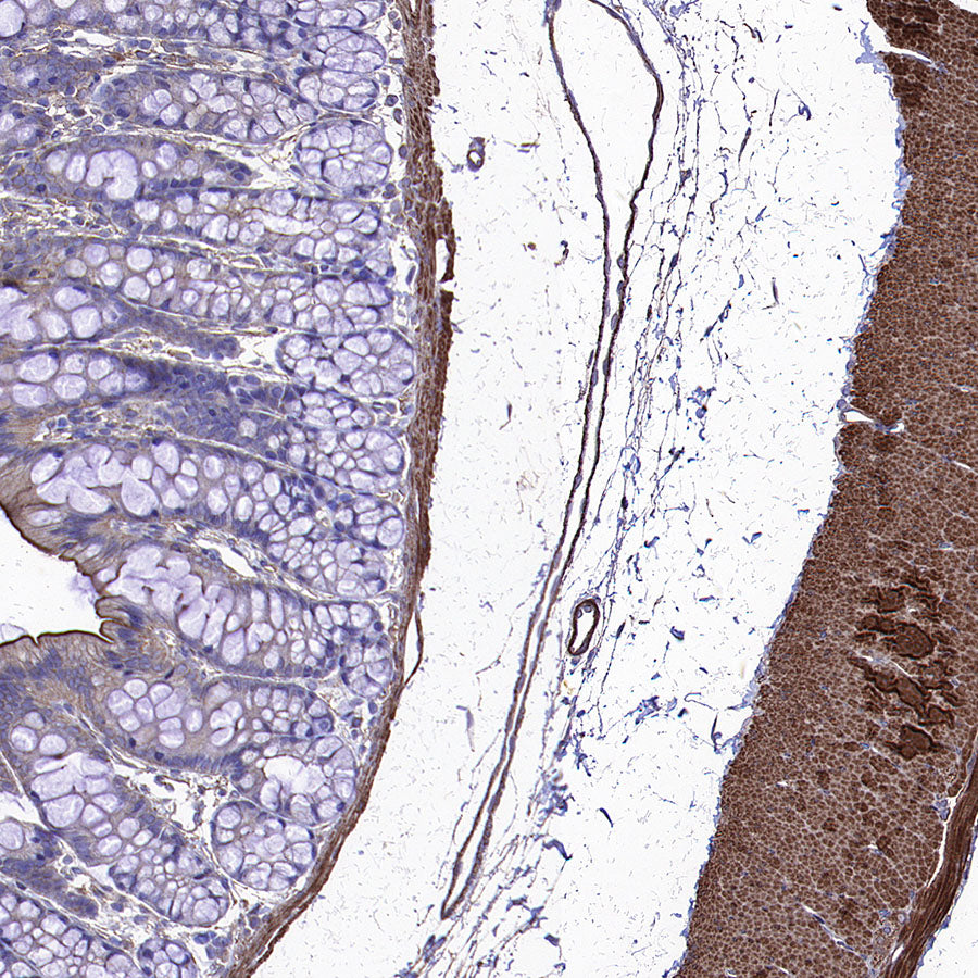 Beta Actin Recombinant Mouse mAb (S-5033)