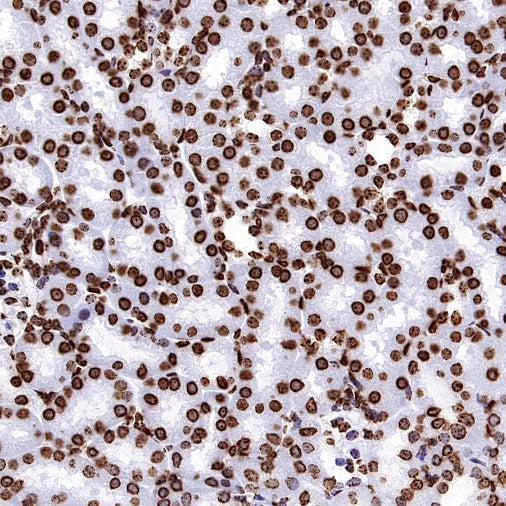 Histone H3 (tri methyl K9) Recombinant Rabbit mAb (S-3826)