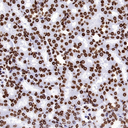 Histone H3 (tri methyl K9) Recombinant Rabbit mAb (S-3826)