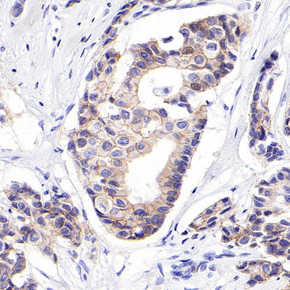 S-RMab® ErbB3 Recombinant Rabbit mAb (SDT-991-10)