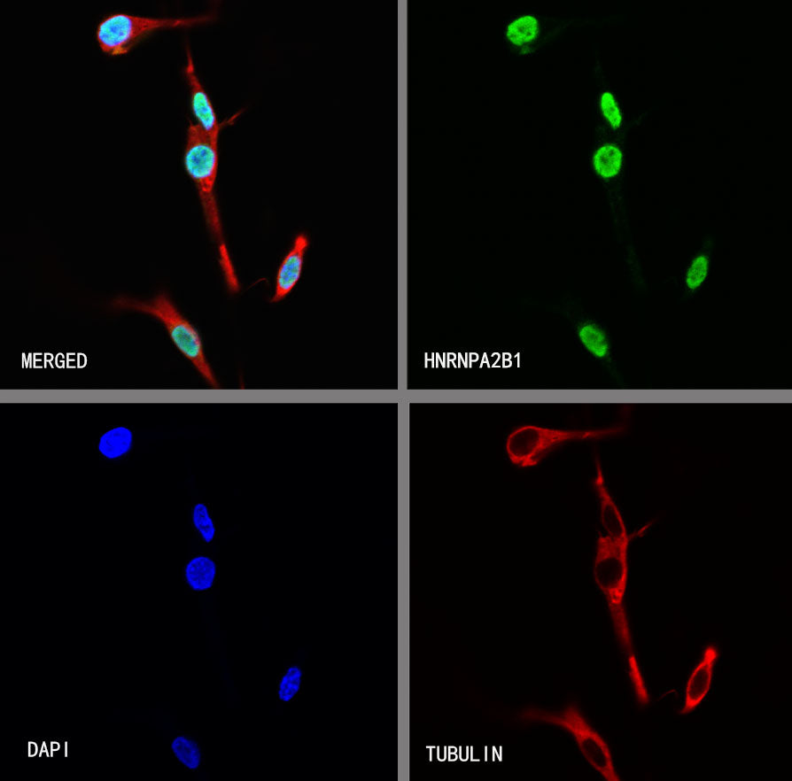 HNRNPA2B1 Mouse mAb