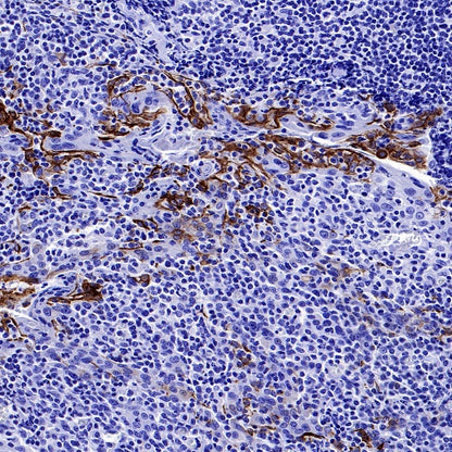 CK7/8 Recombinant Rabbit mAb (SDT-P006)