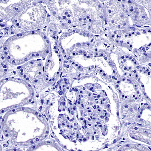 Uteroglobin Recombinant Rabbit mAb ,PBS Only(SDT-2736-46)