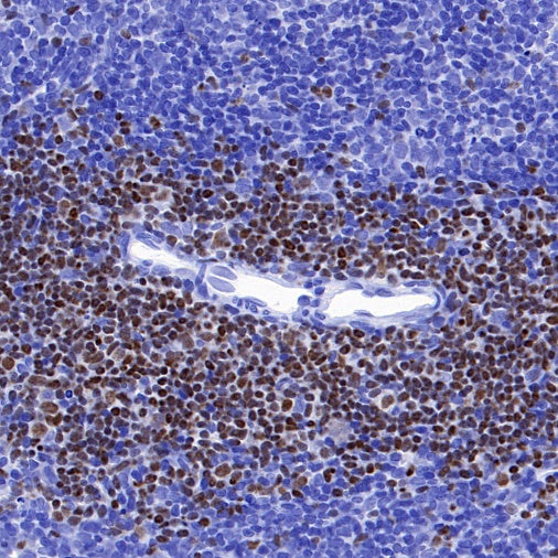 Ctip2 Recombinant Rabbit mAb (S-1375-21)