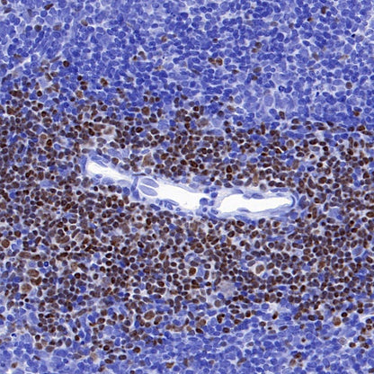 Ctip2 Recombinant Rabbit mAb (S-1375-21)