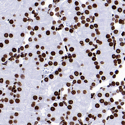 Histone H3 (di methyl K9) Recombinant Rabbit mAb (S-903-52)