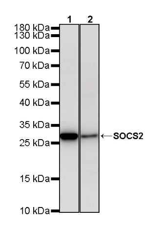 SOCS2 Recombinant Rabbit mAb (S-4956-21)