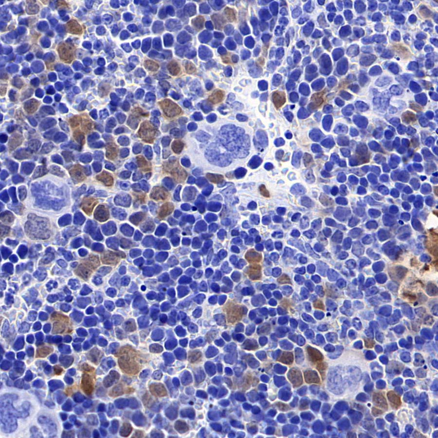 CDK6 Recombinant Rabbit mAb (S-4090-71)