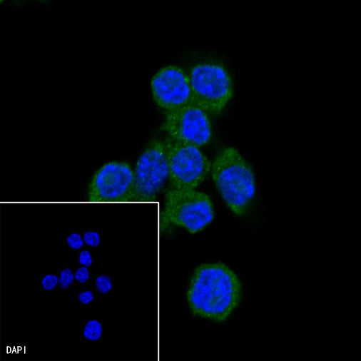 IκBα Recombinant Rabbit mAb (SDT-457-9)