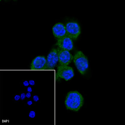 IκBα Recombinant Rabbit mAb (SDT-457-9)