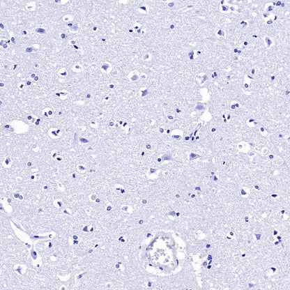 BANK1 Recombinant Rabbit mAb (SDT-2265-37)