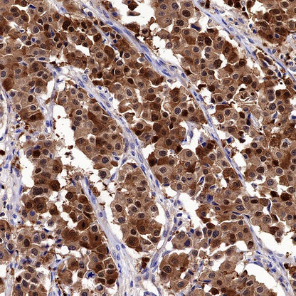 14-3-3 zeta Recombinant Rabbit mAb (S-1092-31)