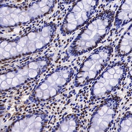 EWSR1/EWS Recombinant Rat mAb (S-R201)