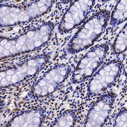 EWSR1/EWS Recombinant Rat mAb (S-R201)