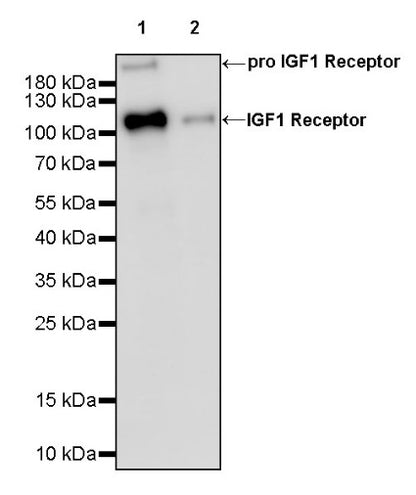 IGF1 Receptor Recombinant Rabbit mAb (S-1617-146)