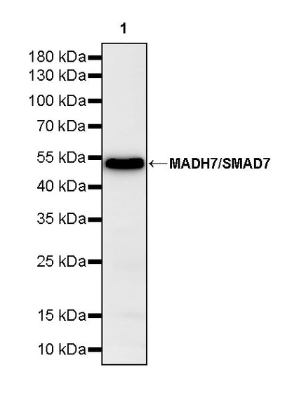 MADH7/SMAD7 Recombinant Rabbit mAb (S-2930-74)