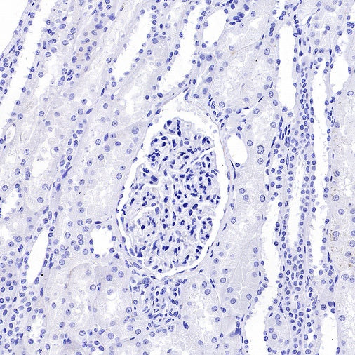 SLC40A1/Ferroportin Recombinant Rabbit mAb (S-2172-35)