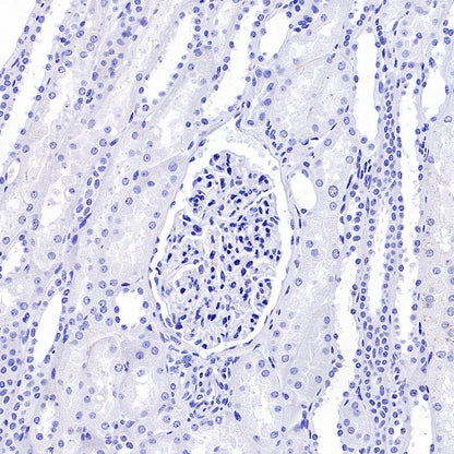 SLC40A1/Ferroportin Recombinant Rabbit mAb (S-2172-35)