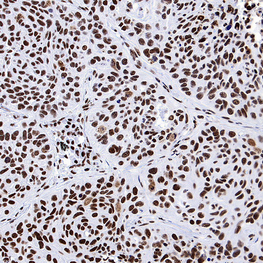 NPM1 Recombinant Rabbit mAb (S-4119-58)