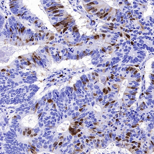 Cyclin A2 Recombinant Rabbit mAb (S-2554-2)