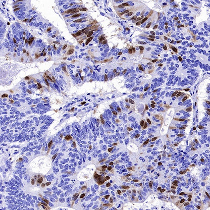 Cyclin A2 Recombinant Rabbit mAb (S-2554-2)