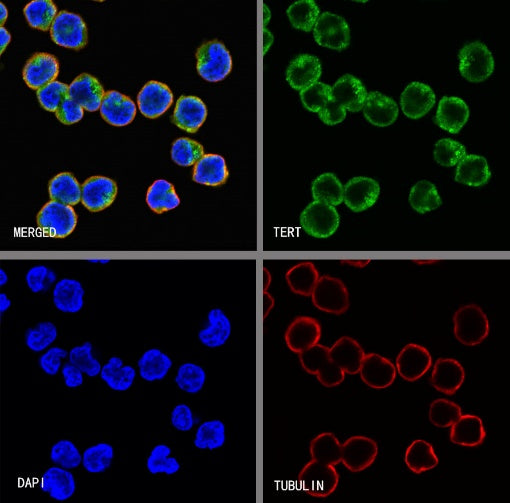 TERT Recombinant Rabbit mAb (S-1246-143)