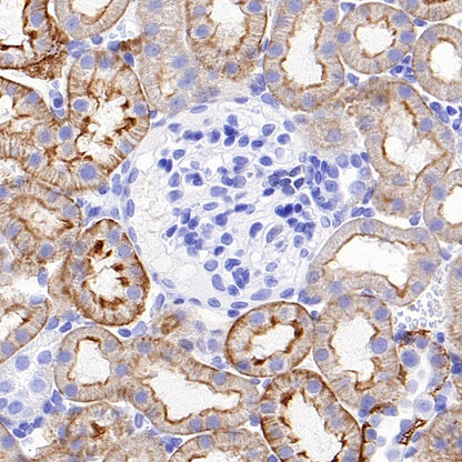TRPV4 Recombinant Rabbit mAb (S-1746-65)