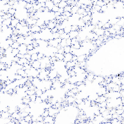 Homer1 Recombinant Rabbit mAb (S-3405-360)