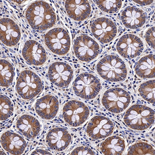 Bad Recombinant Rabbit mAb (S-976-26)