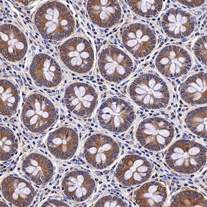 Bad Recombinant Rabbit mAb (S-976-26)
