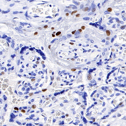 p57 Recombinant Rabbit mAb (SDT-191-79)