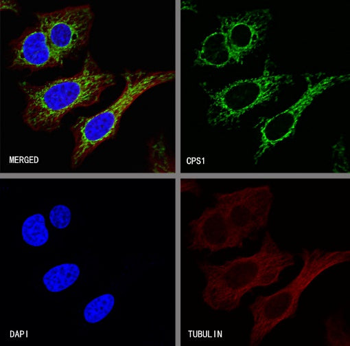 CPS1 Recombinant Rabbit mAb (S-674-9)