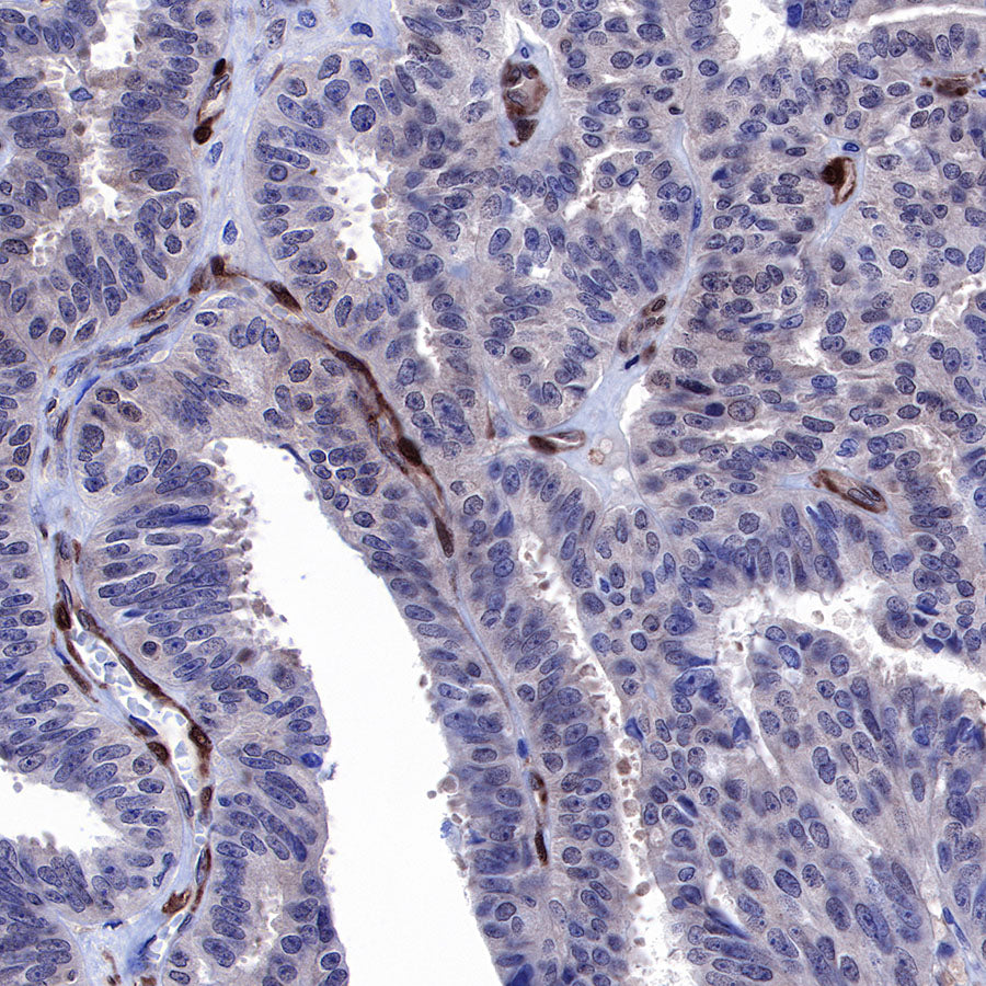 S-RMab® PTEN Recombinant Rabbit mAb (SDT-R069)