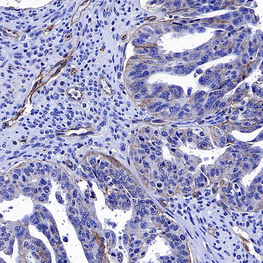 CD151 Recombinant Rabbit mAb (S-3235-104)