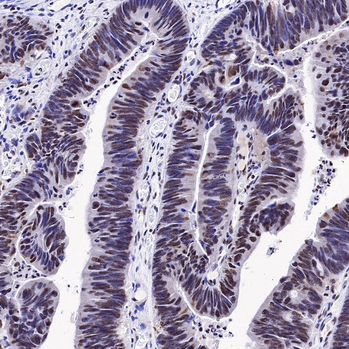 HMGB1 Recombinant Rabbit mAb (S-R305)