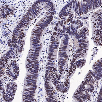 HMGB1 Recombinant Rabbit mAb (S-R305)