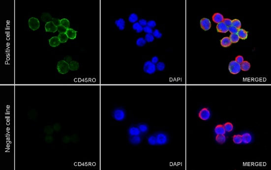Mouse Anti-Human CD45RO Antibody (UCHL1)