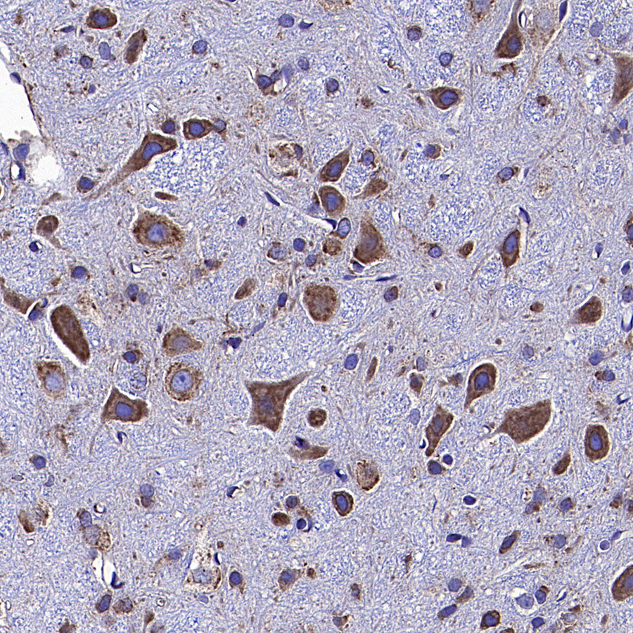 Calreticulin Recombinant Rabbit mAb (S-3920-39)
