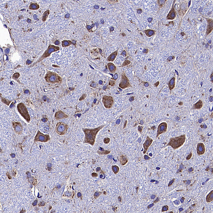 Calreticulin Recombinant Rabbit mAb (S-3920-39)