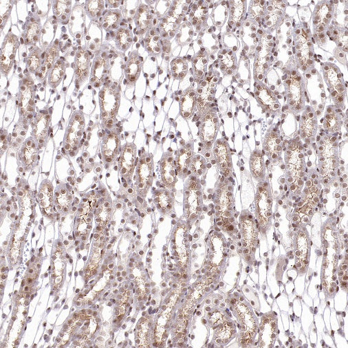 APC6 Recombinant Rabbit mAb (S-2550-48)